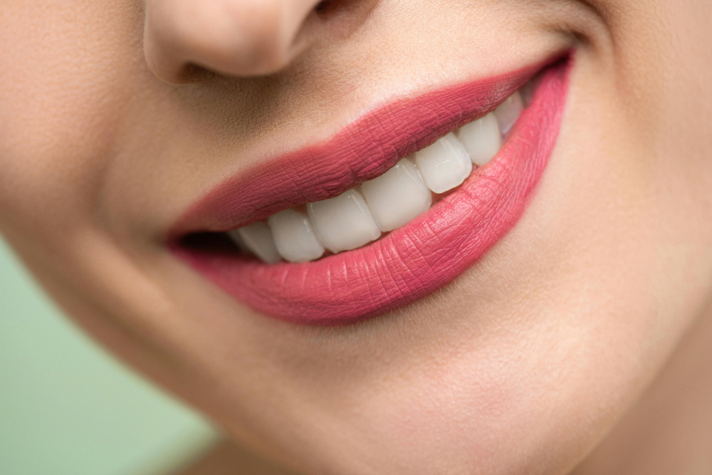 Tratamientos de estética dental para una sonrisa hermosa en UltraDental Perú