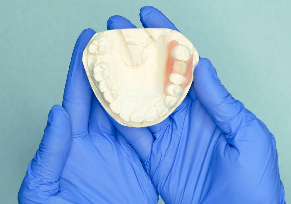 Prótesis dentales estéticas y funcionales en UltraDental Lima