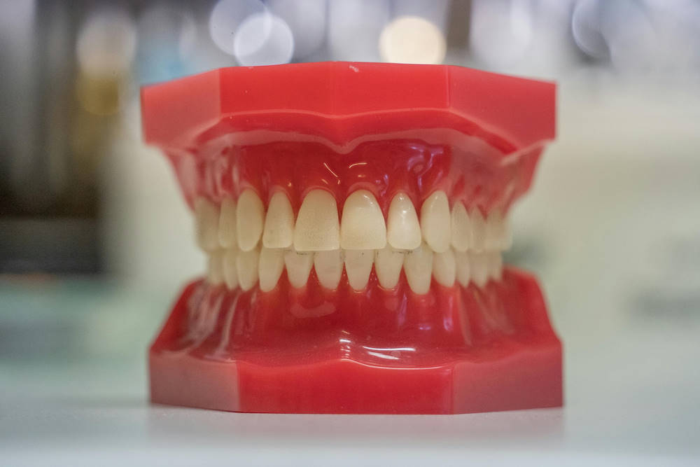 Periodoncia en UltraDental Lima, Perú